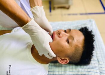 Thanh niên ở Phú Thọ bị trật khớp quai hàm, không khép được miệng do ngáp lớn